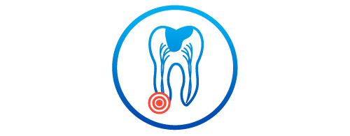 Endodoncja (w tym leczenie kanałowe pod mikroskopem)